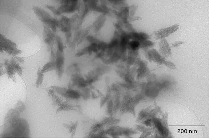 У мозку людини виявили цілу ложку нанопластику: які наслідки це має для здоров'я