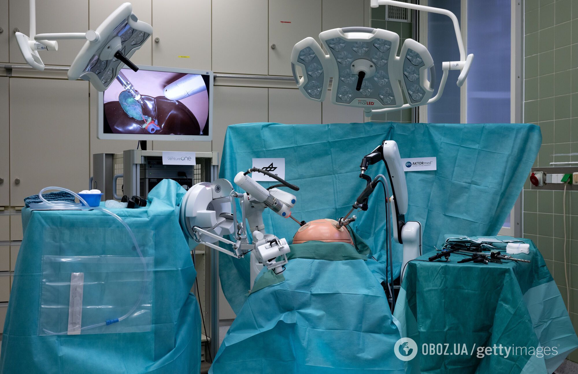 Хірурги зможуть оперувати пацієнтів віддалено: що за технологія 6G, яка "змінює правила гри"