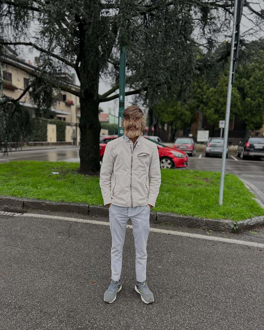 Обличчя на 95% вкрите волоссям: унікальний підліток із синдромом перевертня потрапив у Книгу рекордів Гіннеса. Фото 