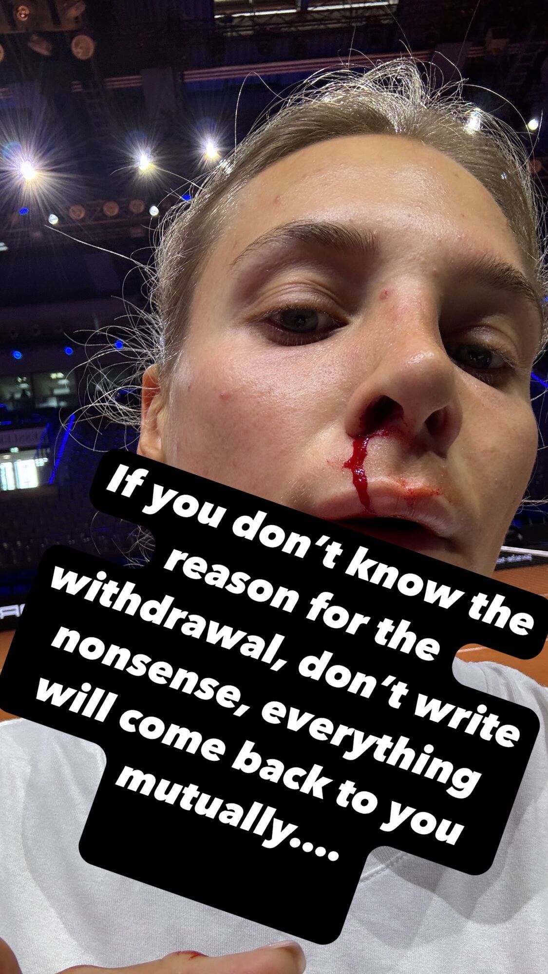 Знаменитая украинская теннисистка отказалась выступать и ушла посредине матча на турнире в Штутгарте. Видео