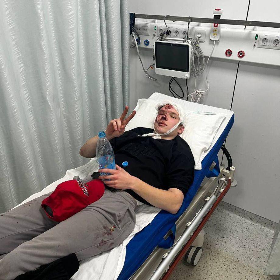 Российскому экс-хоккеисту выстрелили в голову из ракетницы. Фото и видео