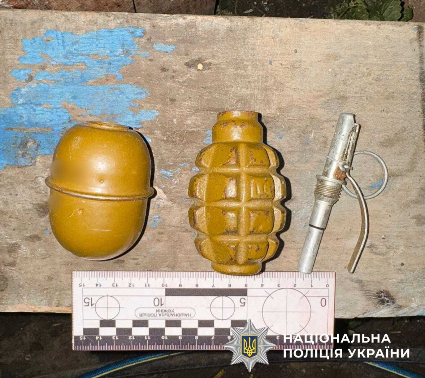 Нашел у отца и играл: в руках у парня в Киевской области взорвалась граната. Фото