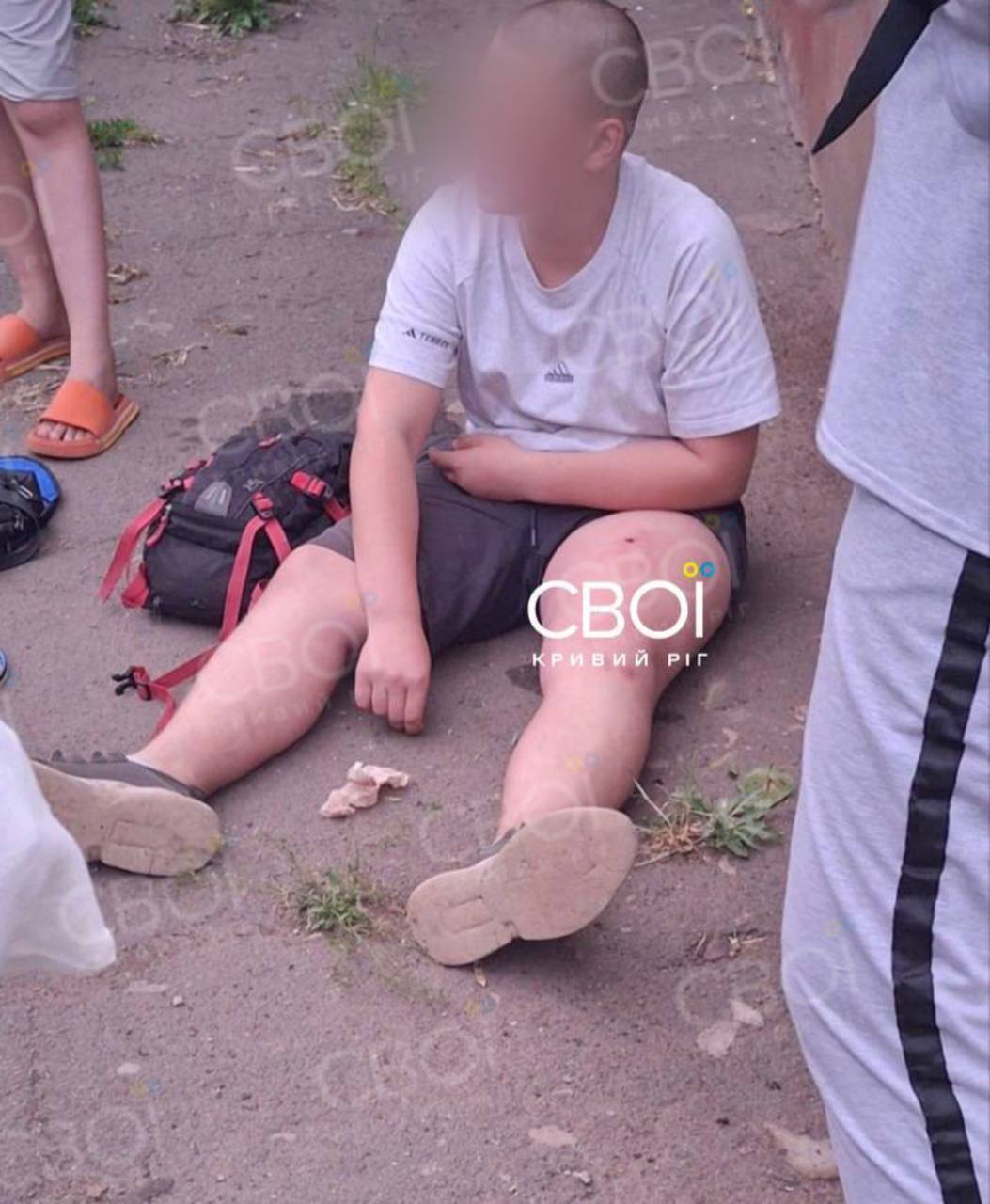 "Услышали только свист": в Кривом Роге выстрелили в ногу ребенку на площадке. Фото