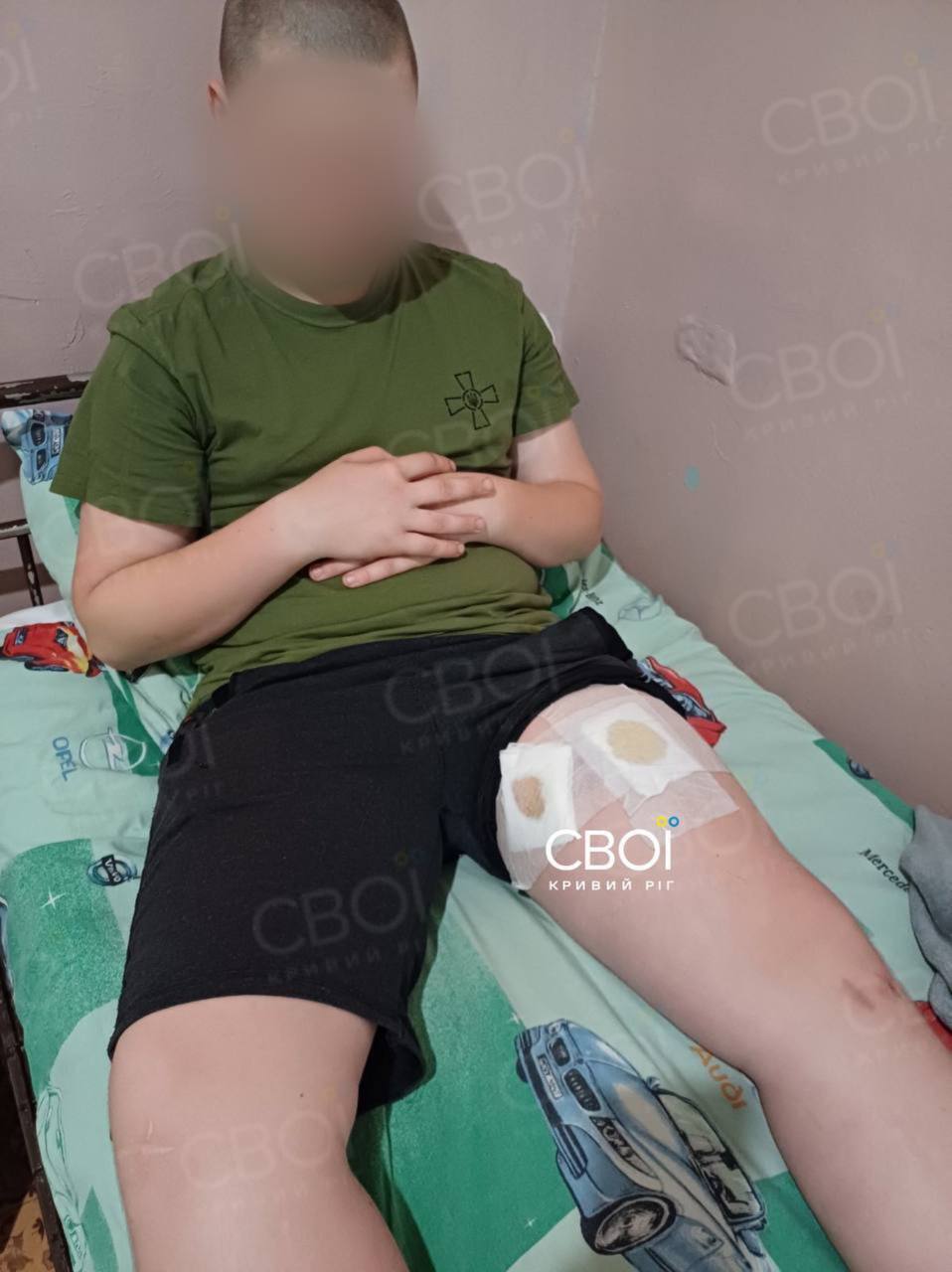 "Услышали только свист": в Кривом Роге выстрелили в ногу ребенку на площадке. Фото
