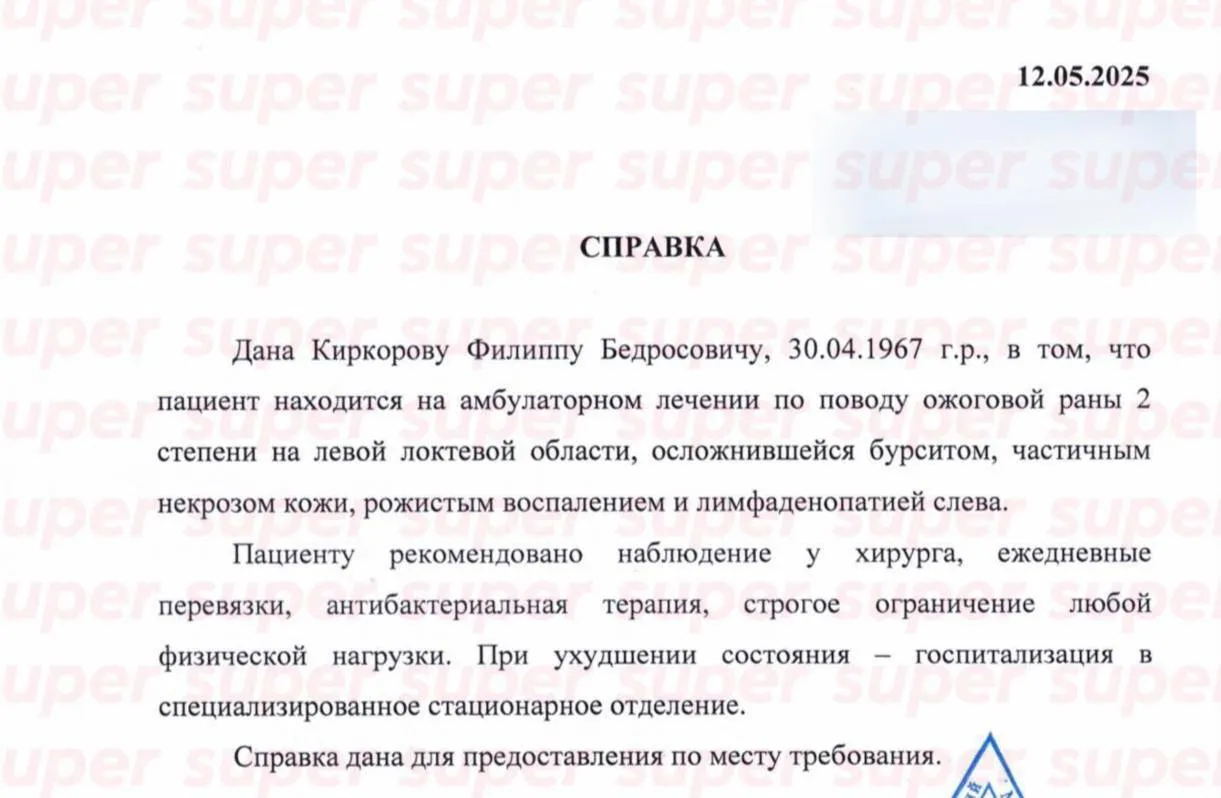 Путіністу Кіркорову, який обгорів на концерті, стало гірше: росіян закликали молитися