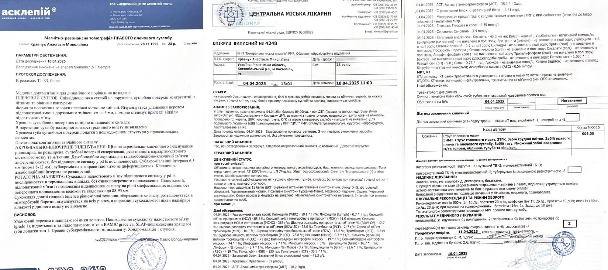 На Рівненщині чоловік збив жінку, яка їхала на велосипеді: за словами потерпілої, поліція намагається закрити справу. Фото