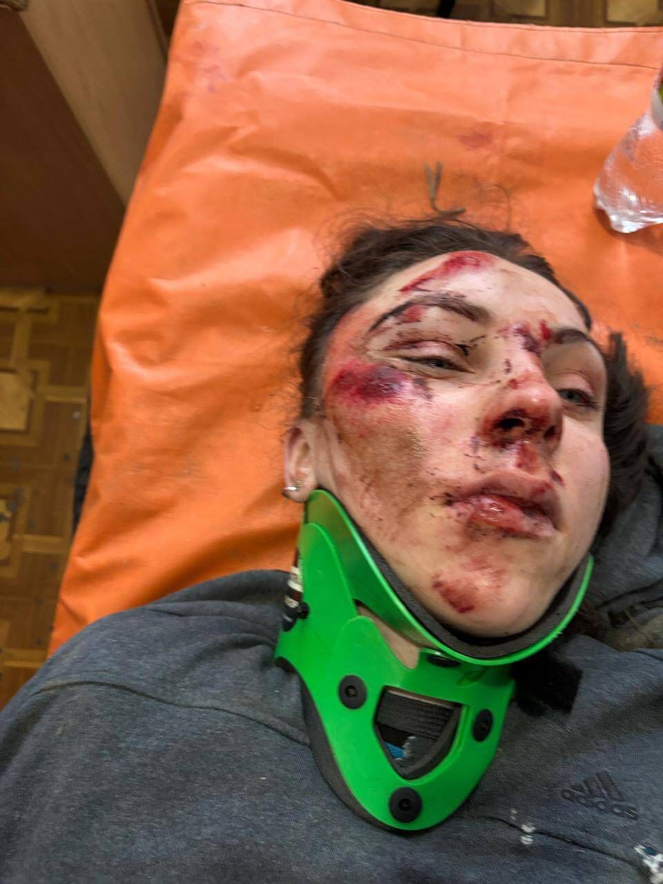 На Рівненщині чоловік збив жінку, яка їхала на велосипеді: за словами потерпілої, поліція намагається закрити справу. Фото