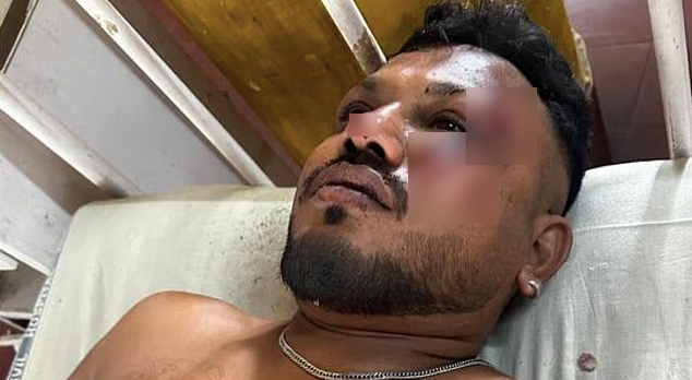 "Думав, що помираю": чоловік, який вижив під час падіння літака в Індії, розповів про момент катастрофи. Фото