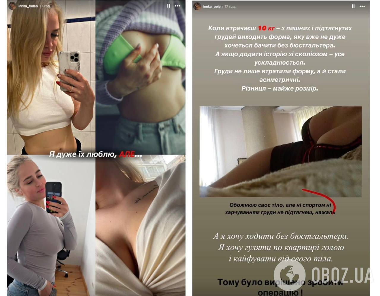 Колишня дівчина "Терена" Інна Бєлєнь зробила дві пластичні операції та розповіла, що змінила в собі. Фото