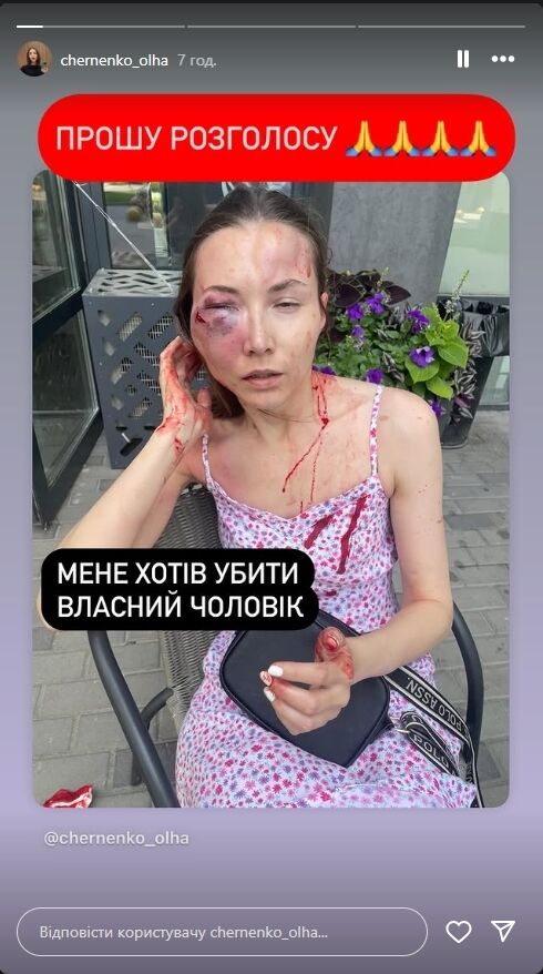 Безжально бив ногами: у Києві чоловік напав на дружину біля її квартири. Усі подробиці та фото