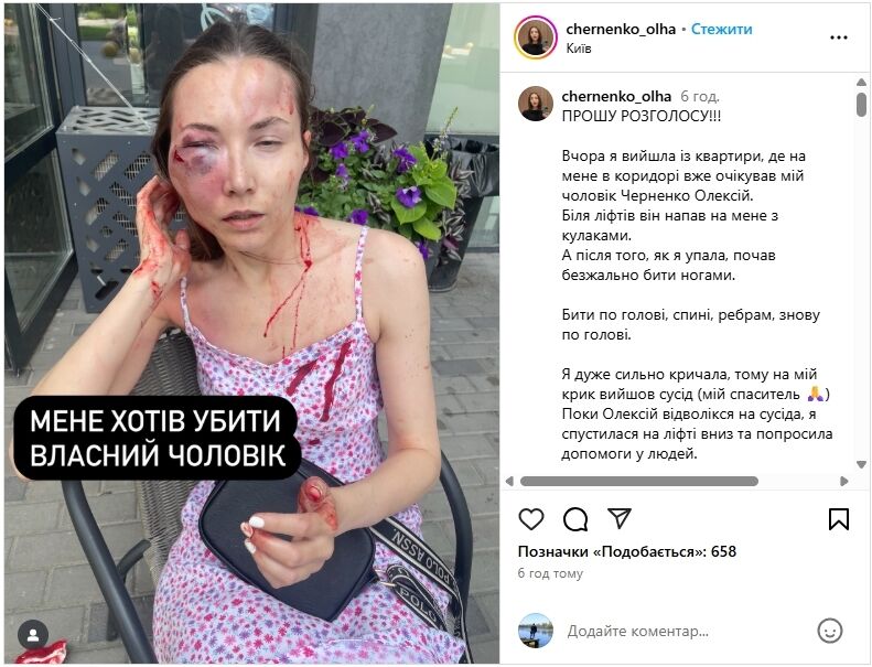 Безжально бив ногами: у Києві чоловік напав на дружину біля її квартири. Усі подробиці та фото