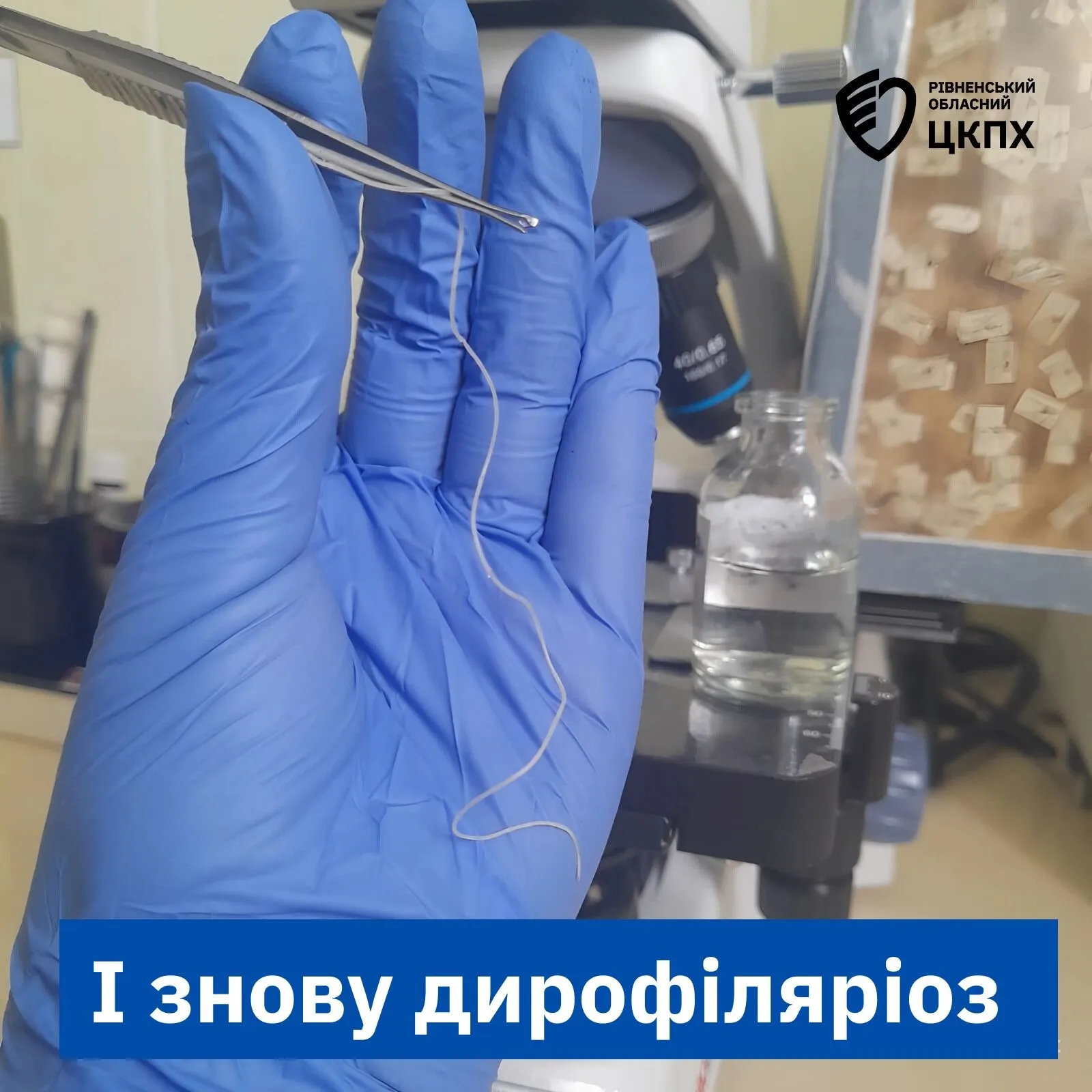 Жаловалась на слабость и отеки: на Ривненщине из глаза у женщины достали 11-сантиметрового гельминта. Фото