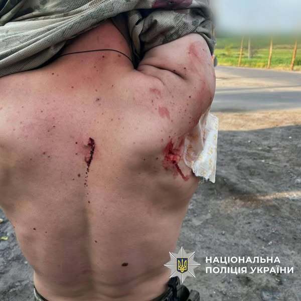 На Харьковщине вражеский дрон атаковал полицейское авто: есть раненые. Фото 18+