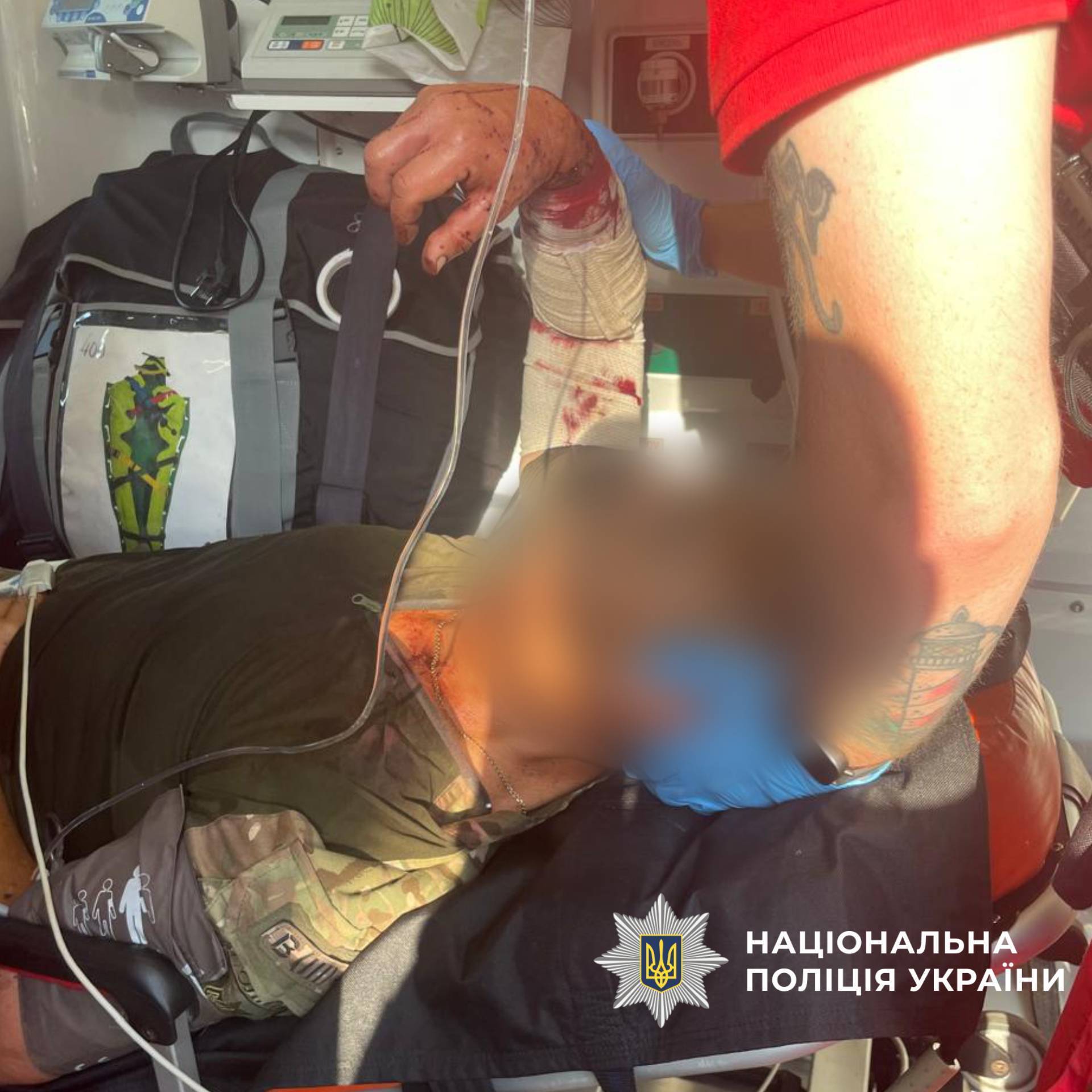 На Харьковщине вражеский дрон атаковал полицейское авто: есть раненые. Фото 18+
