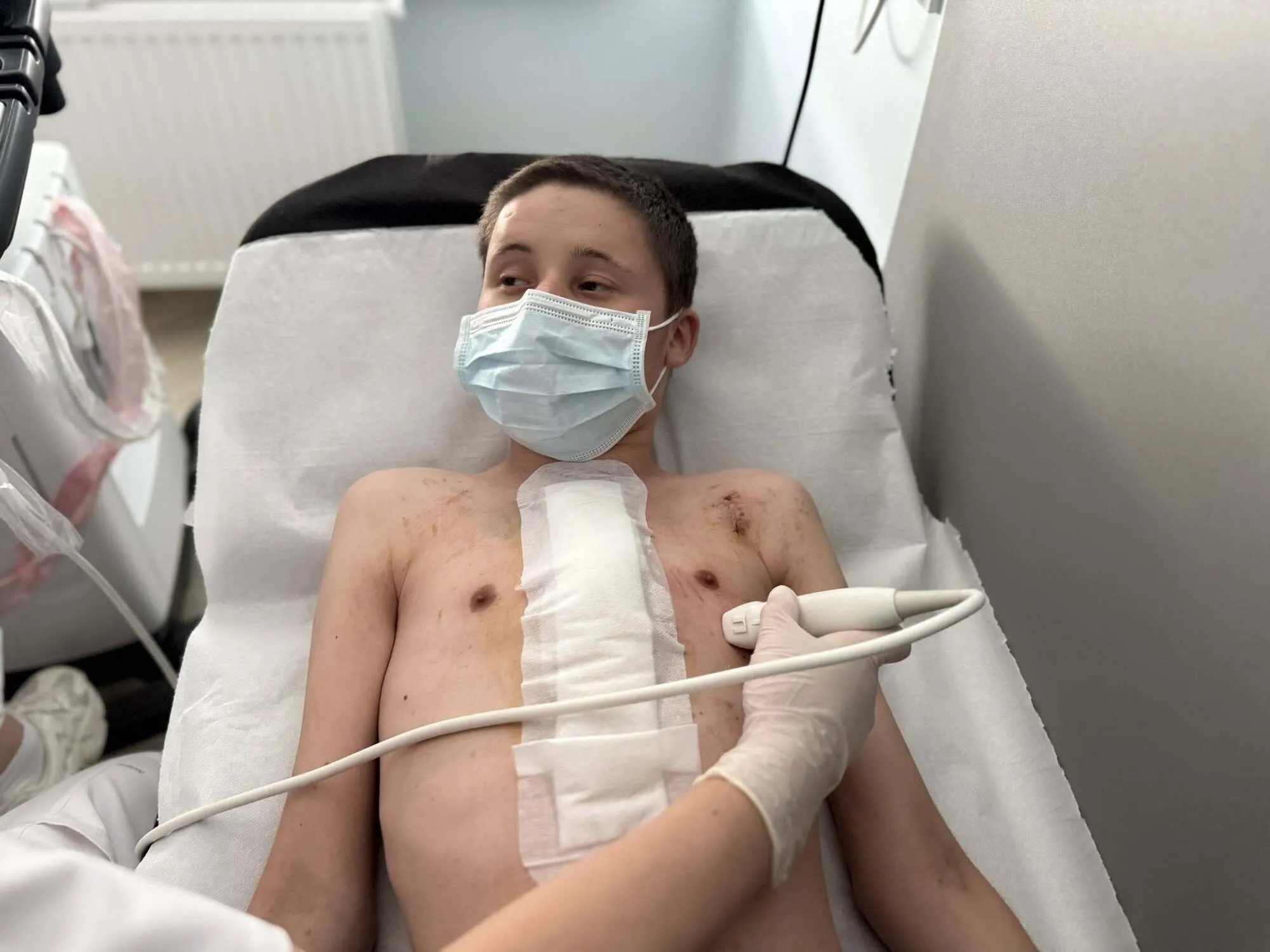 Перше відмовило через годину після операції: у Львові 20-річному хлопцю пересадили два серця за три дні. Фото