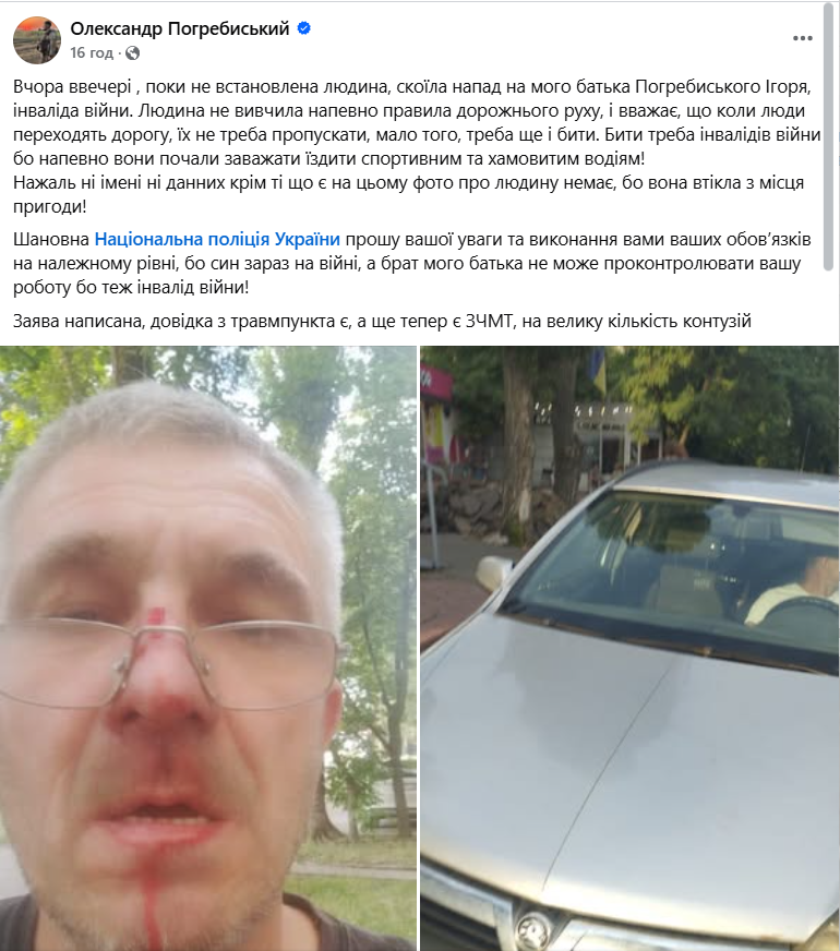 У Києві водій побив батька депутата Київради, який є інвалідом війни: зловмисника затримали. Фото