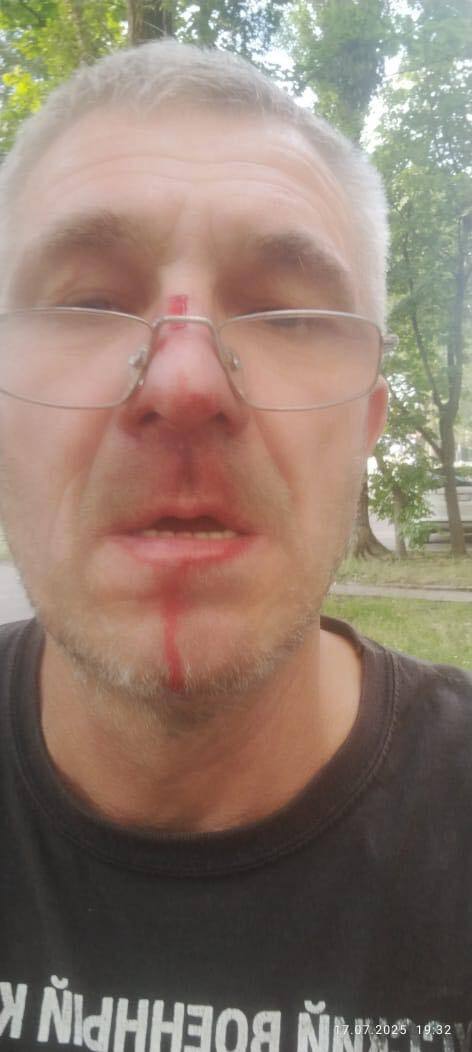 У Києві водій побив батька депутата Київради, який є інвалідом війни: зловмисника затримали. Фото