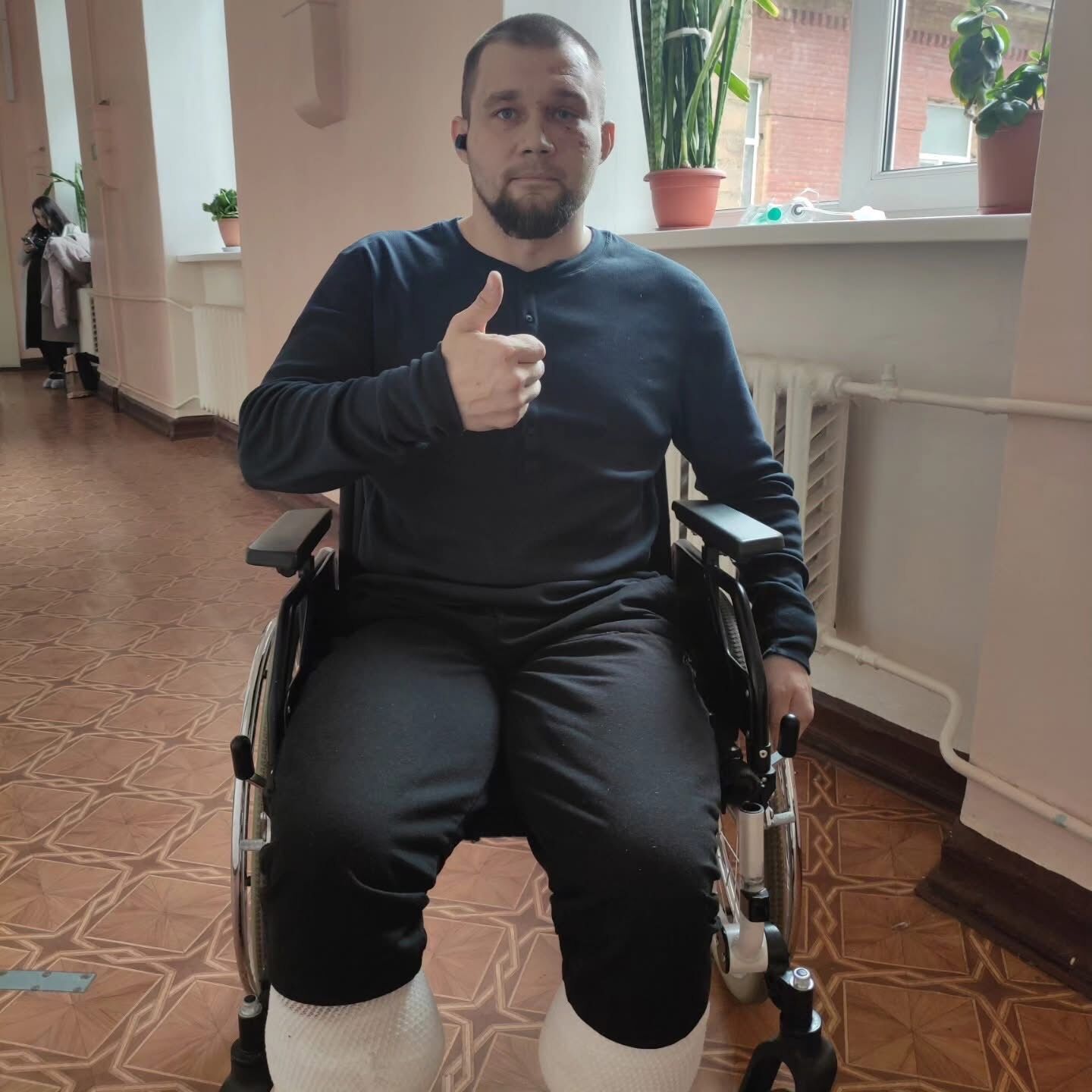 Міцніший за залізо: історія впертого сапера, який вижив після підриву на протитанковій міні