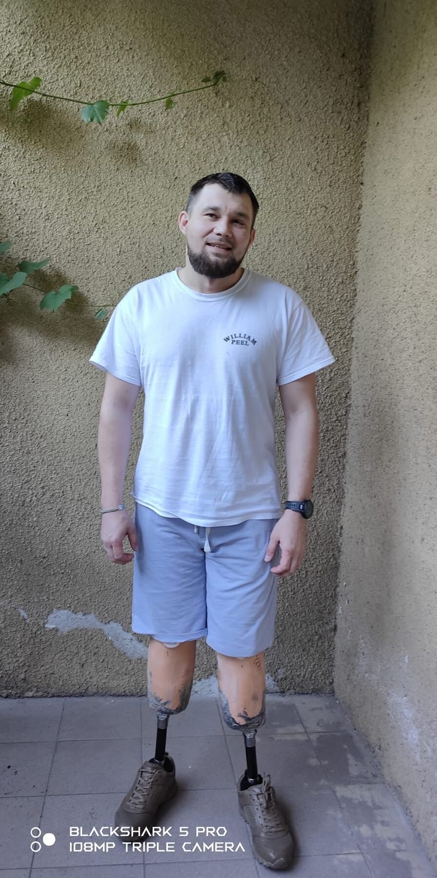 Міцніший за залізо: історія впертого сапера, який вижив після підриву на протитанковій міні