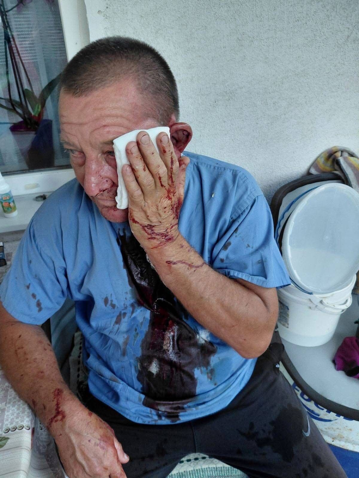 На Киевщине подростки жестоко избили отца погибшего нацгвардейца: у нападавших оказались родственники в правоохранительных органах. Фото