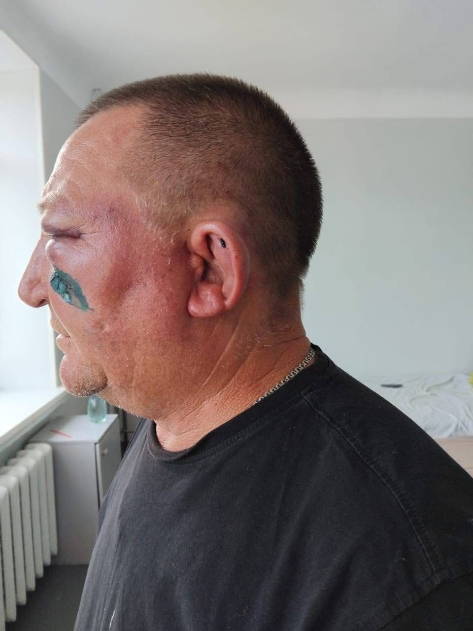 На Киевщине подростки жестоко избили отца погибшего нацгвардейца: у нападавших оказались родственники в правоохранительных органах. Фото