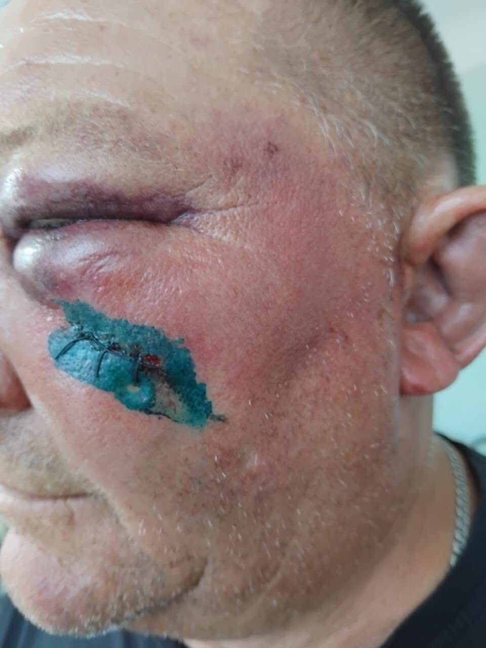На Киевщине подростки жестоко избили отца погибшего нацгвардейца: у нападавших оказались родственники в правоохранительных органах. Фото
