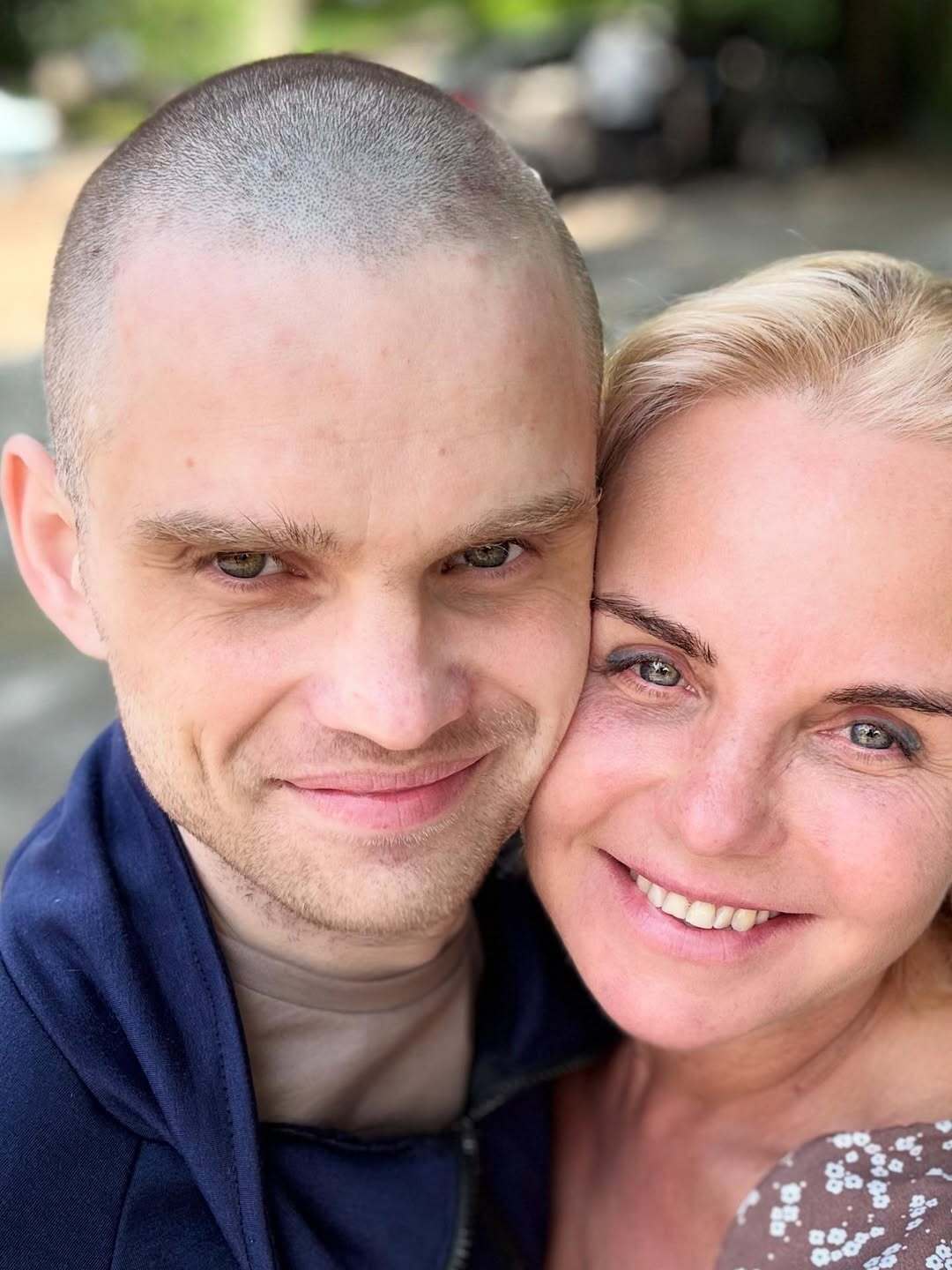 "Не було ані бинтів, ані шовного матеріалу": мережу вразила історія захисника Маріуполя, якого хірурги врятували за допомогою мішка