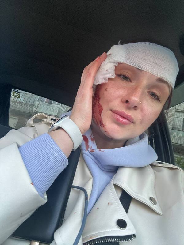 "Дыхание ракеты ни с чем не сравнить – журналисты рассказали, как работают в прифронтовом Запорожье