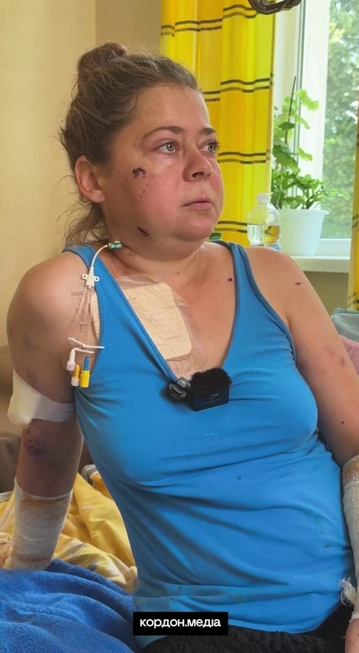 "Ми тільки сіли на зупинці – й одразу приліт": пасажирка автобуса на Сумщині, по якому вдарили окупанти, розповіла про атаку. Відео