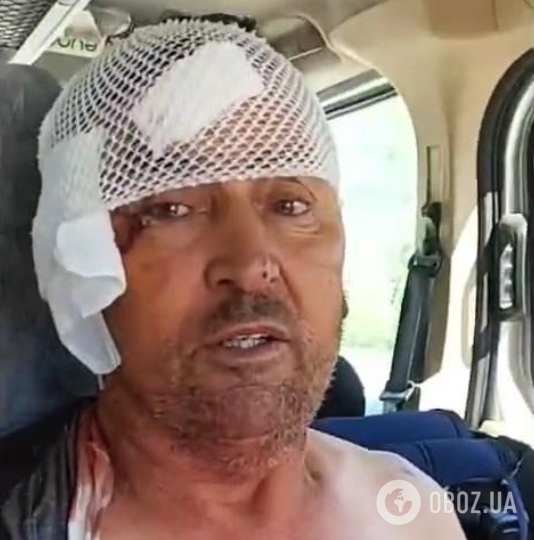 В Турции лев сбежал из зоопарка и напал на фермера, который спал на улице: как спасали мужчину
