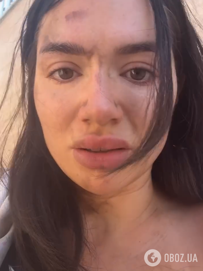 Участницу "Холостяка" хотели изнасиловать среди бела дня: жертву обвинили в "провокации" и заставили оправдываться. Фото, видео