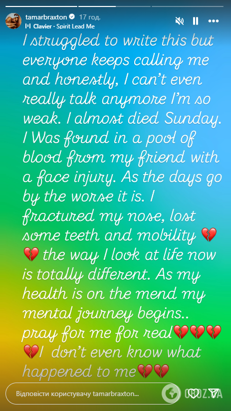 Сестру-певицу легендарной Тони Брэкстон нашли в луже крови с ужасными травмами: что известно