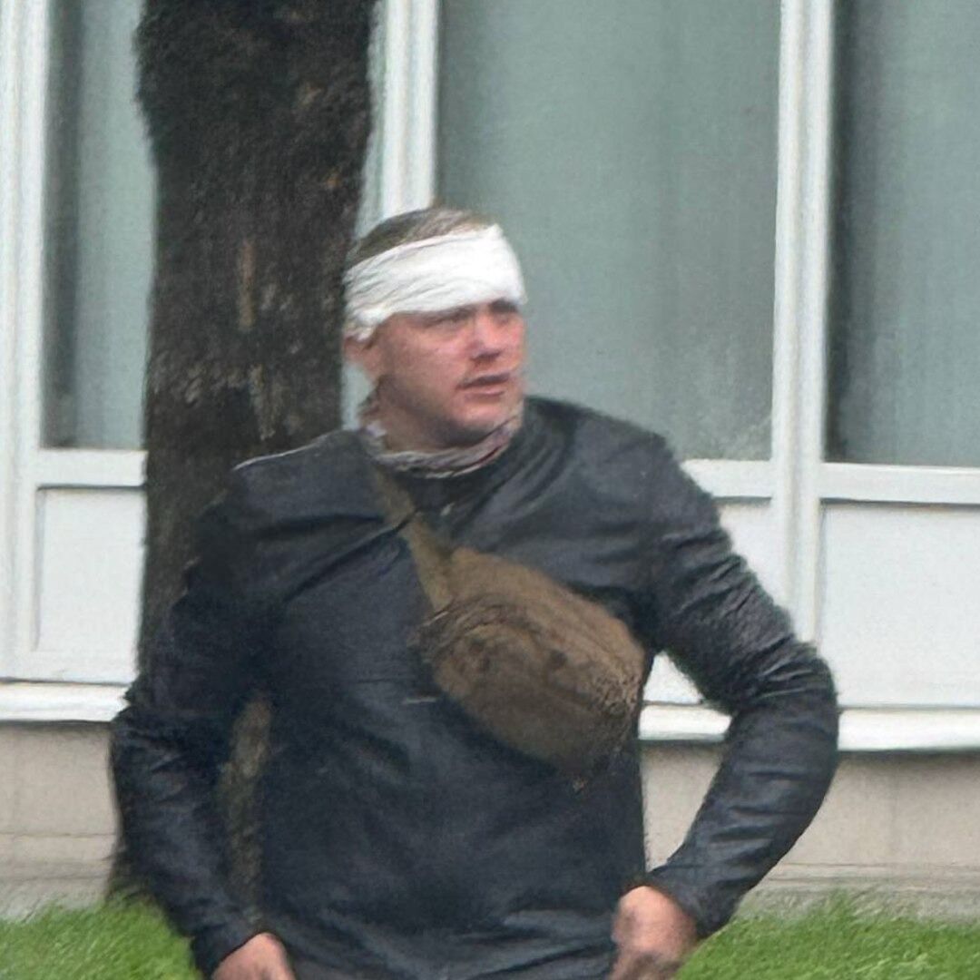 Разбили нос и оштрафовали: российского блогера, который вернулся с войны в Украине, избили в центре Москвы. Фото