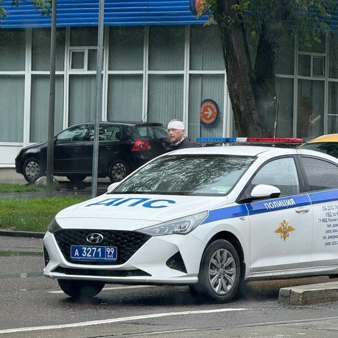 Разбили нос и оштрафовали: российского блогера, который вернулся с войны в Украине, избили в центре Москвы. Фото