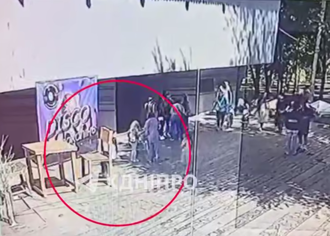 У Дніпрі стілець з артінсталяції впав на дівчинку, вона дістала черепно-мозкову травму: медики розповіли про стан дитини