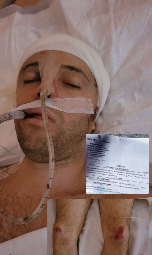 На Черкащині чоловік на ходу вистрибнув із авто ТЦК і помер у лікарні: деталі інциденту