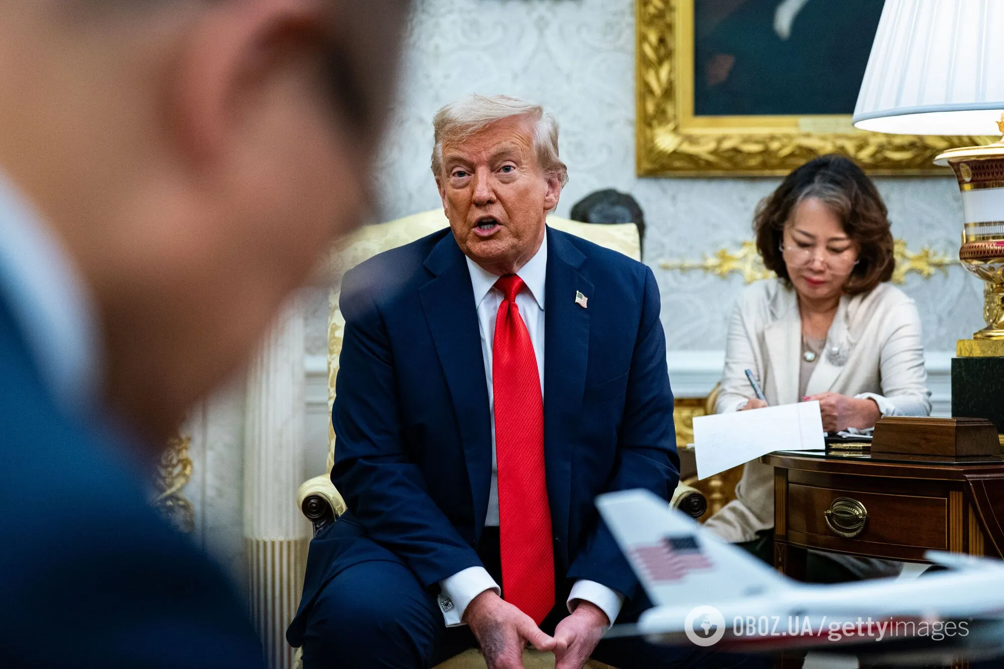 У Трампа знову помітили синець на руці: що відомо про хворобу президента США. Фото