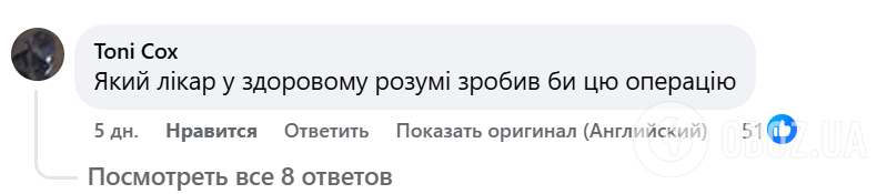 Модель "удалила" все ребра, чтобы достичь экстремально узкой талии: результат шокировал сеть, но есть нюанс. Вирусное видео