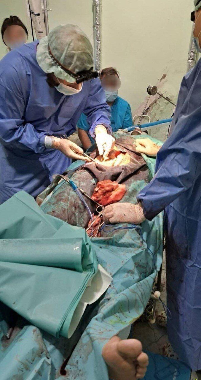 Майор "Гаваї" із ССО: розповідь про те, як вижити і врятувати інших