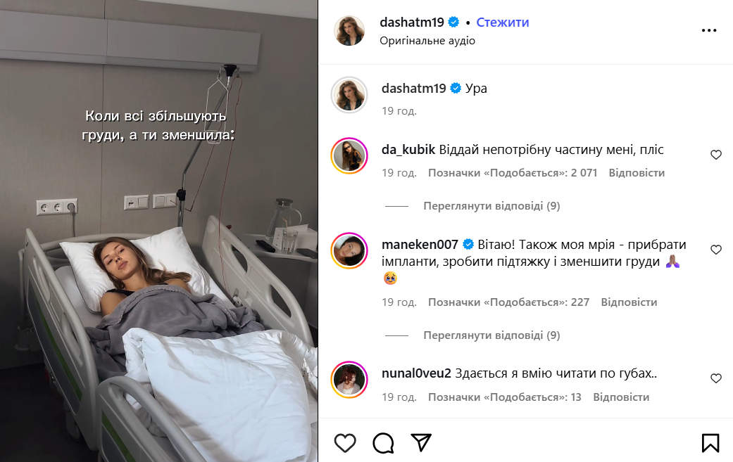 Українська співачка зменшила груди та показала результат: які форми вона мала раніше. Фото