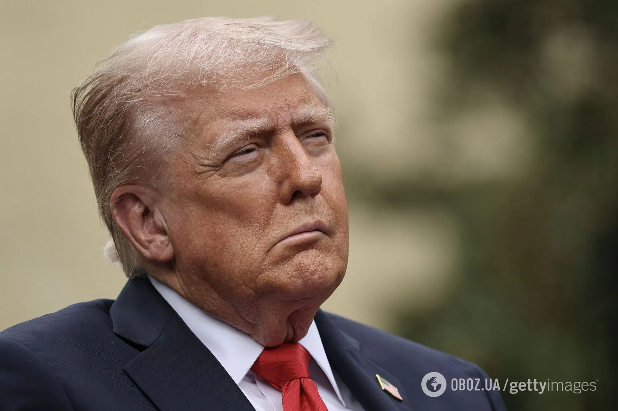 "Схоже на інсульт": нові фото Трампа зблизька викликали занепокоєння в США