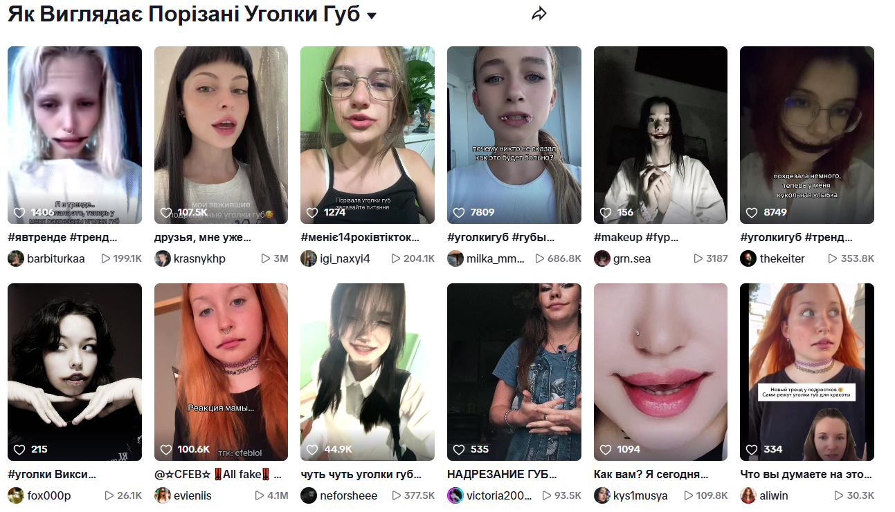 В Украине у подростков новый тренд – разрезать уголки рта ради лайков в соцсетях: чем это грозит и что делать родителям
