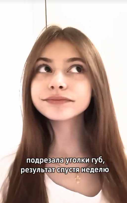 В Украине у подростков новый тренд – разрезать уголки рта ради лайков в соцсетях: чем это грозит и что делать родителям