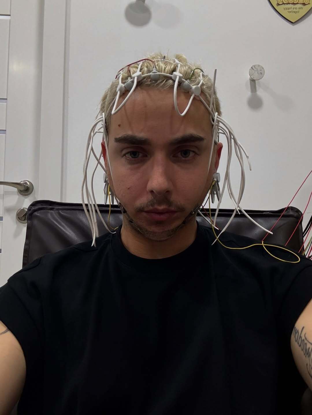 Певец MELOVIN, который попал в психиатрическую больницу, раскрыл свой диагноз: ждет долгий процесс лечения