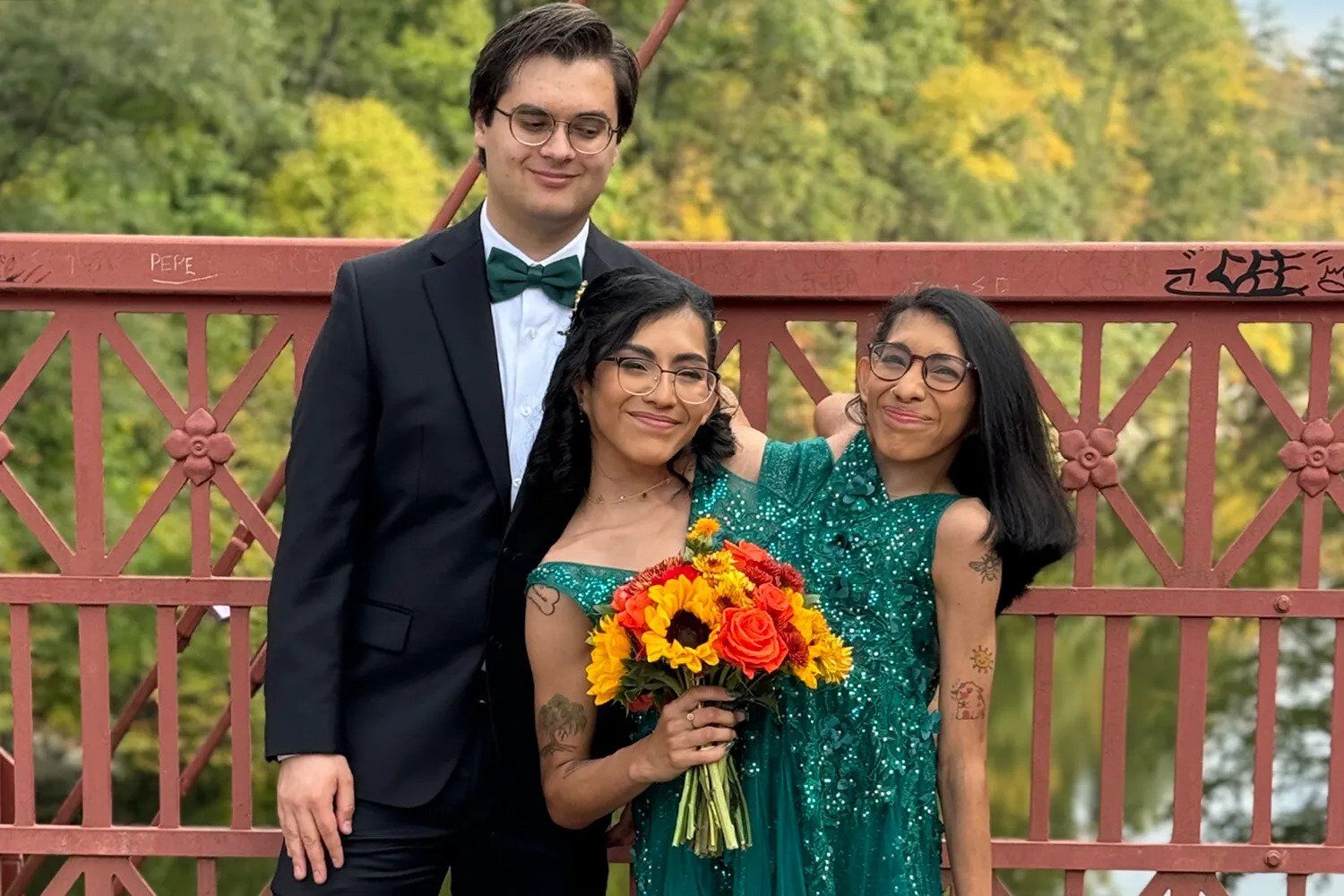 Сиамские близняшки Кармен и Лупита, одна из который год назад вышла замуж, ответили на интимные вопросы и рассказали правду о жизни втроем