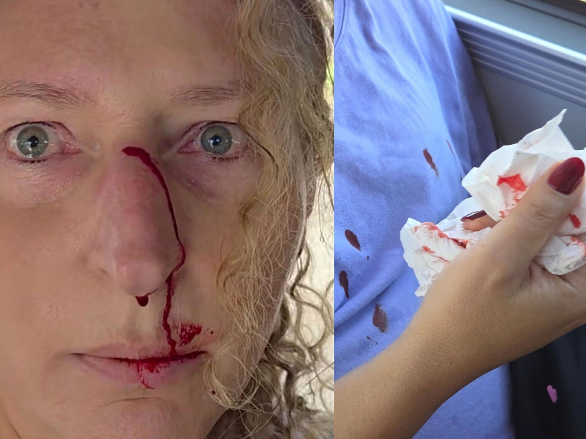 В Варшаве в автобусе избили польскую активистку, которая вступилась за пожилую украинку. Фото