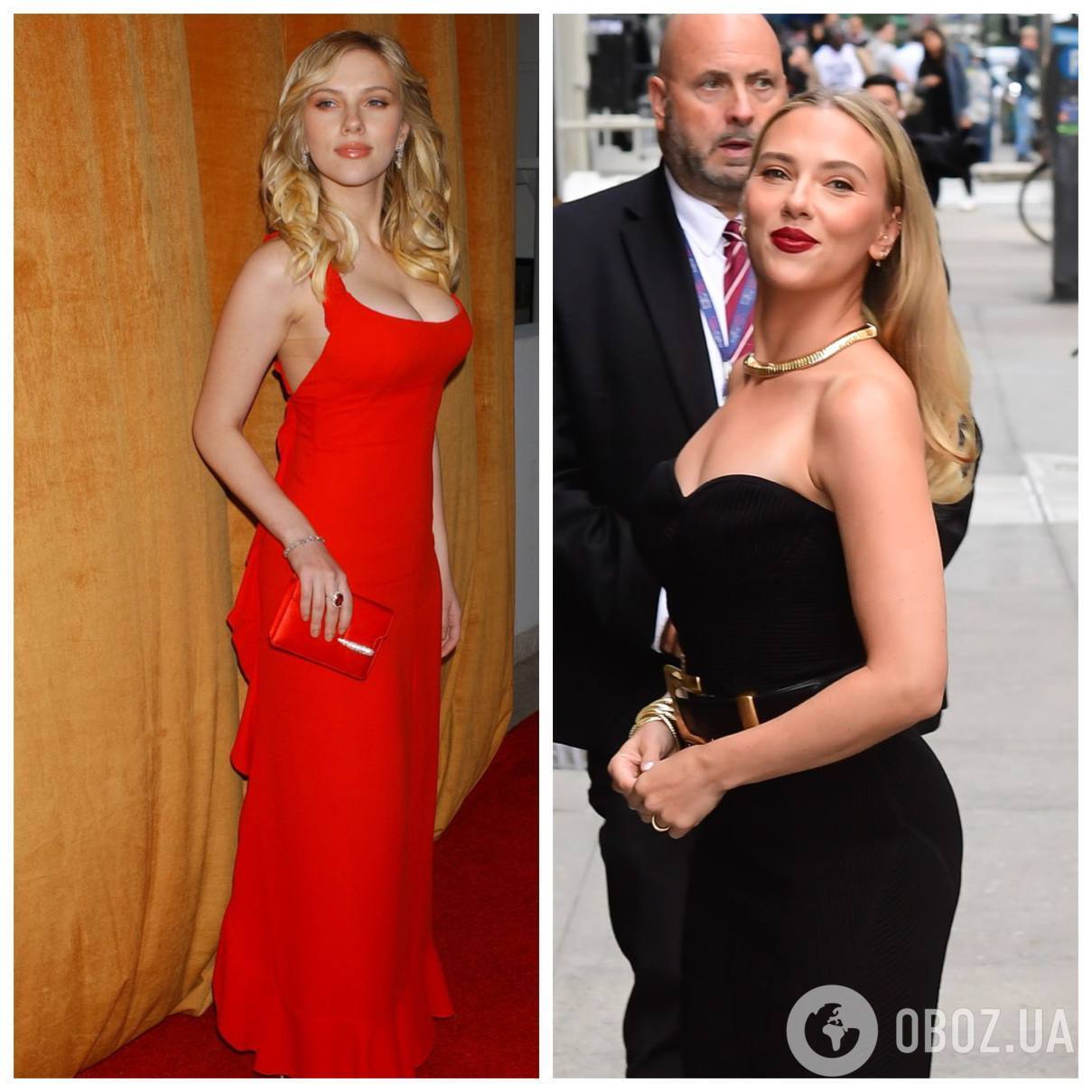 Зірки, які збільшили груди і пошкодували про це: фото до та після мамопластики