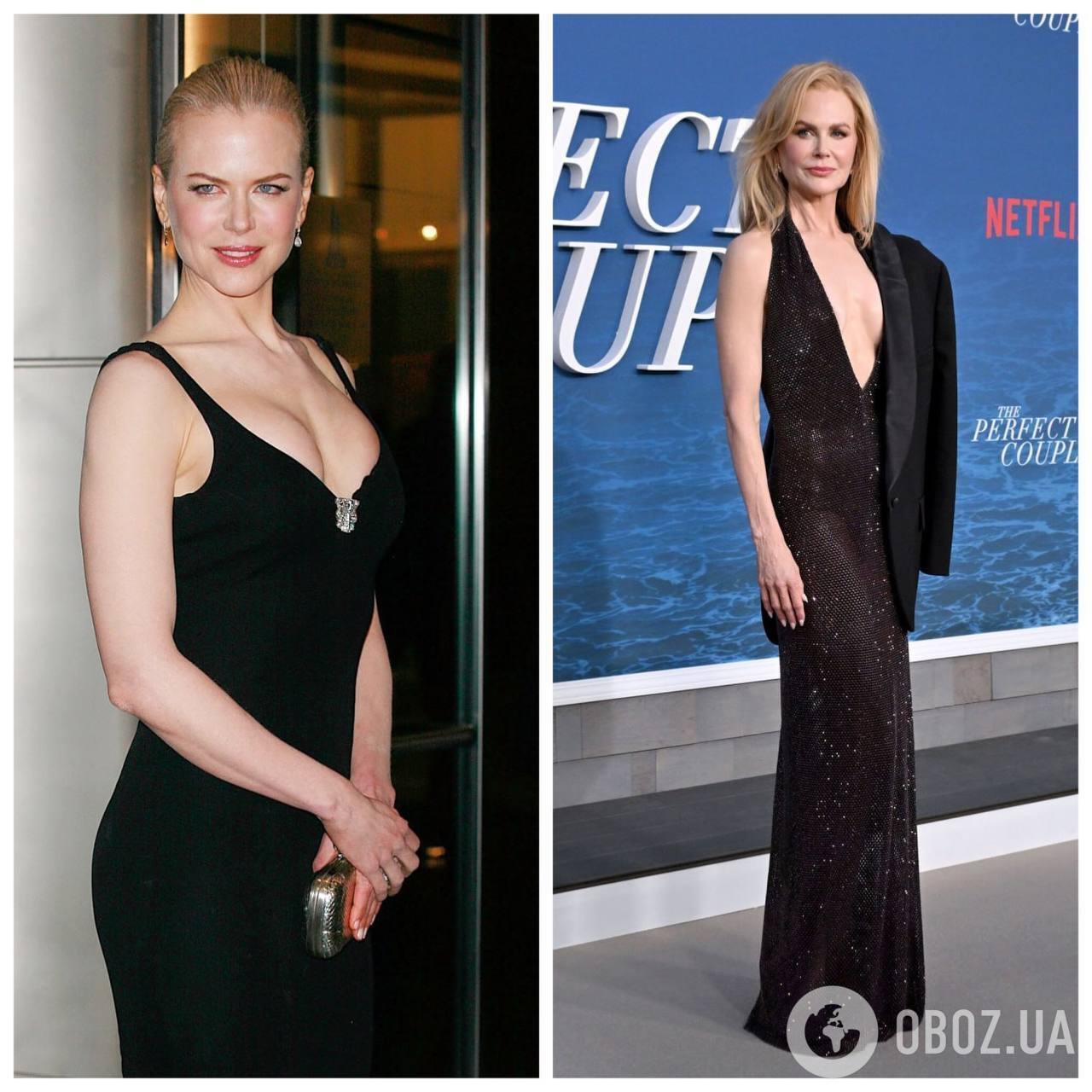 Зірки, які збільшили груди і пошкодували про це: фото до та після мамопластики