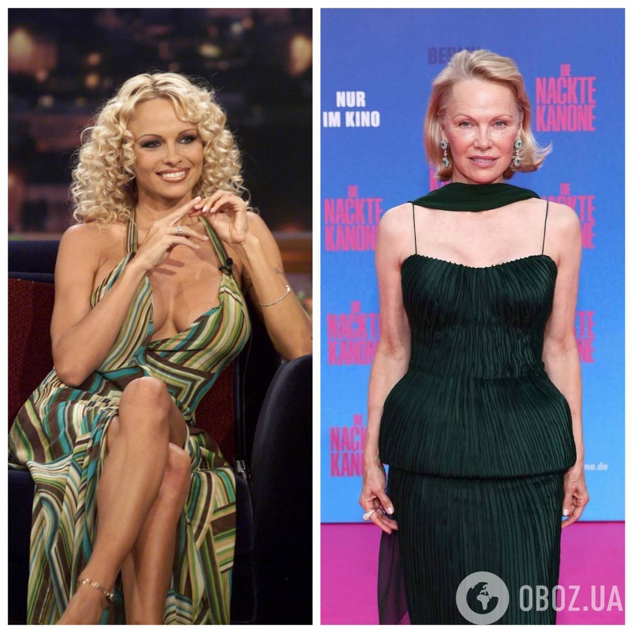 Зірки, які збільшили груди і пошкодували про це: фото до та після мамопластики