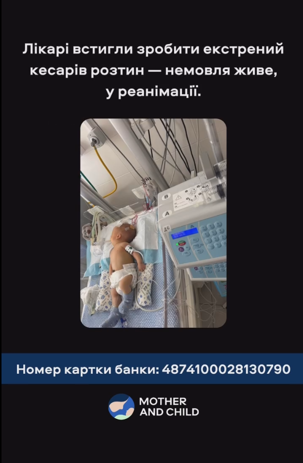 Получил 85% ожогов тела: в Киеве спасают отца маленького Назарчика, который пострадал в результате российской атаки